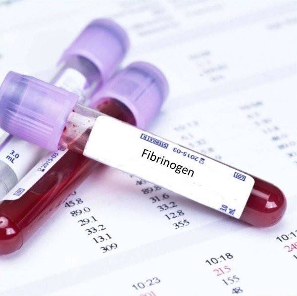 Một trong những xét nghiệm đông máu cơ bản là xét nghiệm định lượng Fibrinogen