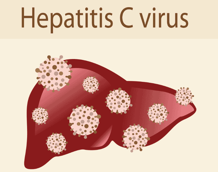 xét nghiệm anti HCV