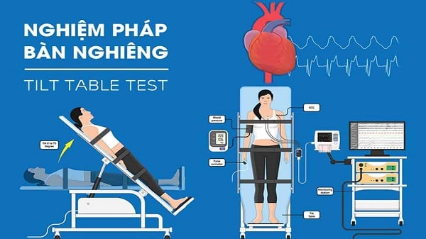 Nghiệm pháp bàn nghiêng giúp chẩn đoán hạ huyết áp tư thế