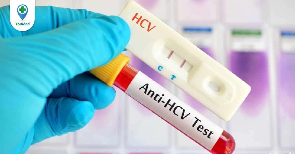 xét nghiệm anti HCV