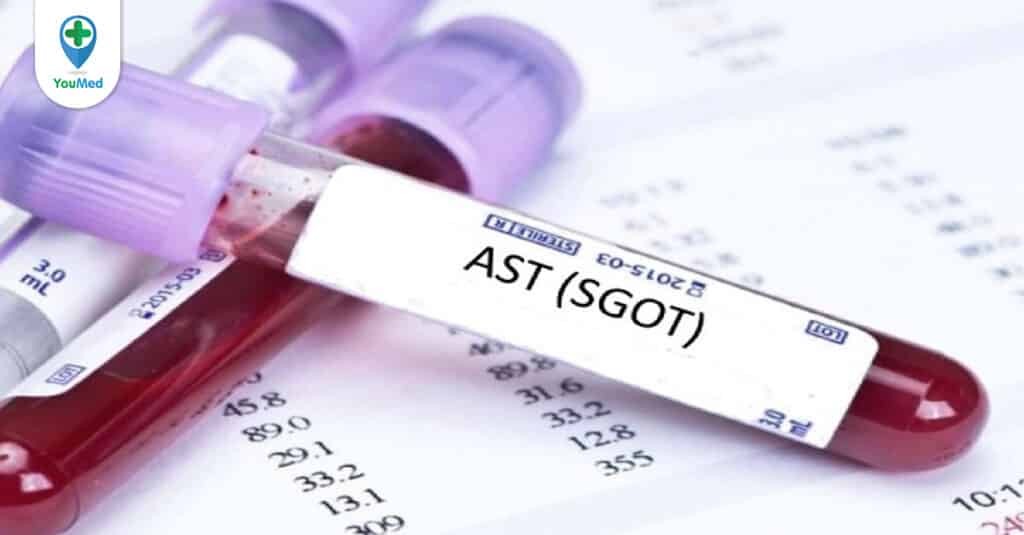 Xét nghiệm AST đánh giá chức năng gan là gì?