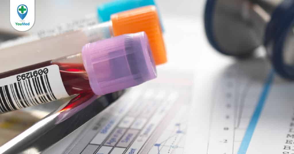 Xét nghiệm ure máu: quy trình, kết quả và lưu ý