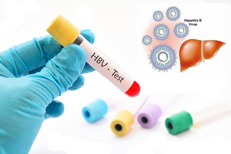 Xét nghiệm viêm gan B giúp phát hiện sớm và điều trị kịp thời bệnh lý viêm gan siêu vi B