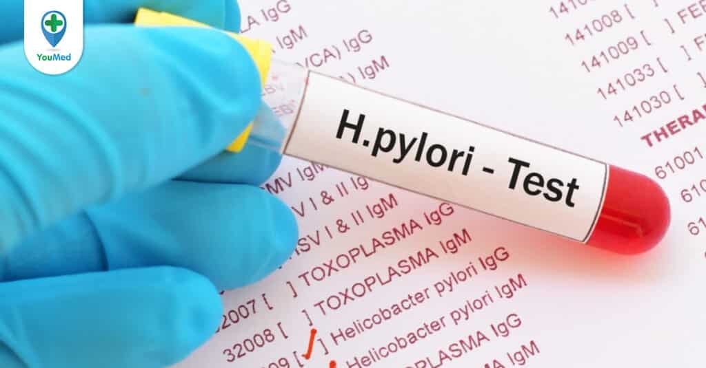 H.pylori Ab và test urease nhanh là xét nghiệm gì?