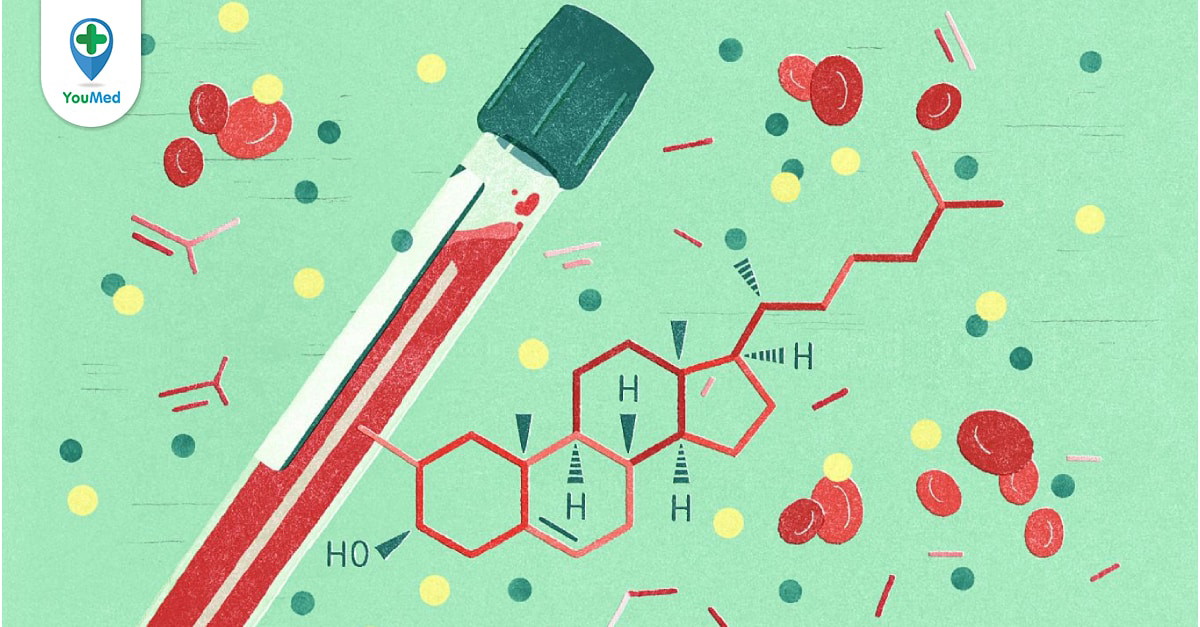 HDL-C cao và thấp có ý nghĩa gì trong xét nghiệm này?
