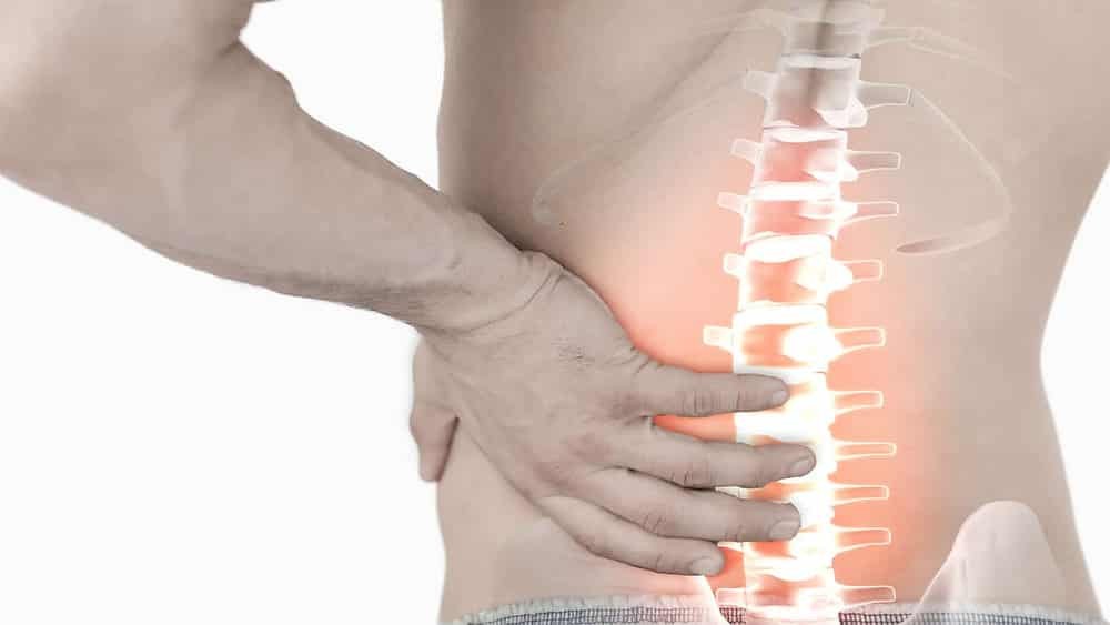 Triệu chứng vẹo cột sống ở người lớn có thể kèm theo đau lưng