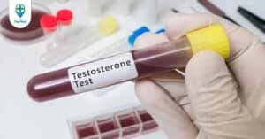 xét nghiệm testosteron