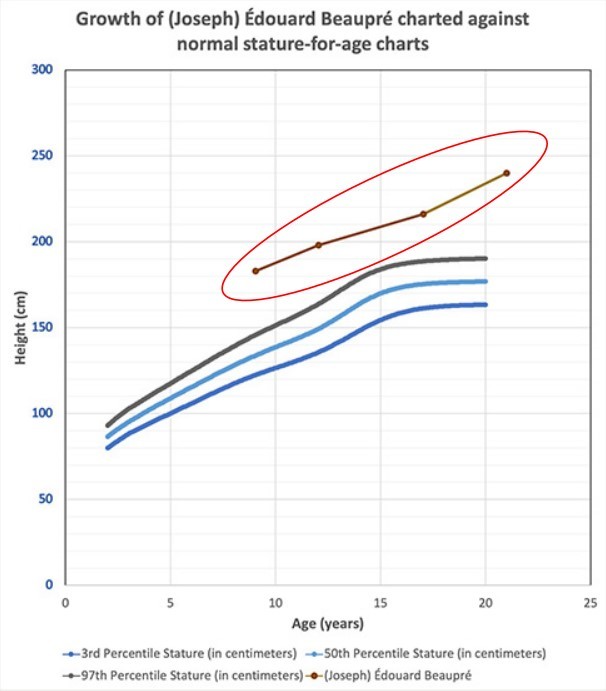 Biểu đồ tăng trưởng của trẻ bị bệnh khổng lồ (trong vòng khoanh đỏ), nằm cao hơn đường +3 SD so với chiều cao trung bình theo tuổi và giới