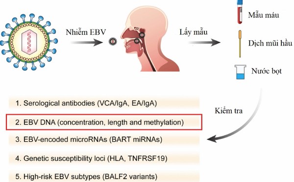 Tầm soát ung thư vòm họng dựa vào xét nghiệm vi rút EPSTEIN-BARR