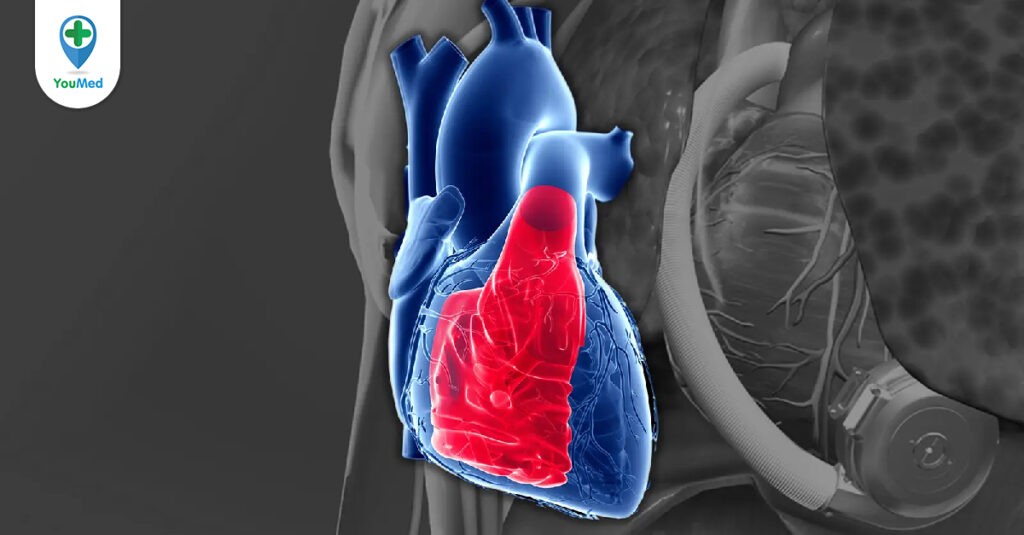 Suy tim phải: Nguyên nhân, triệu chứng và cách điều trị