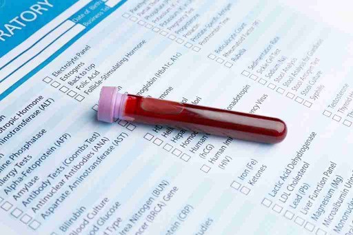 Xét nghiệm máu đánh giá chức năng tuyến giáp