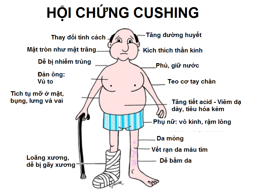 Sử dụng thuốc kéo dài có thể gây ra hội chứng Cushing