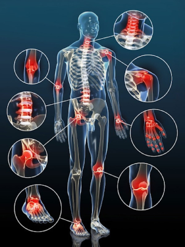  Thoái hóa khớp có thể xảy ra hầu như mọi vị trí trên cơ thể