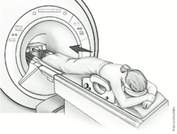 Tư thế chuẩn chụp MRI vú.