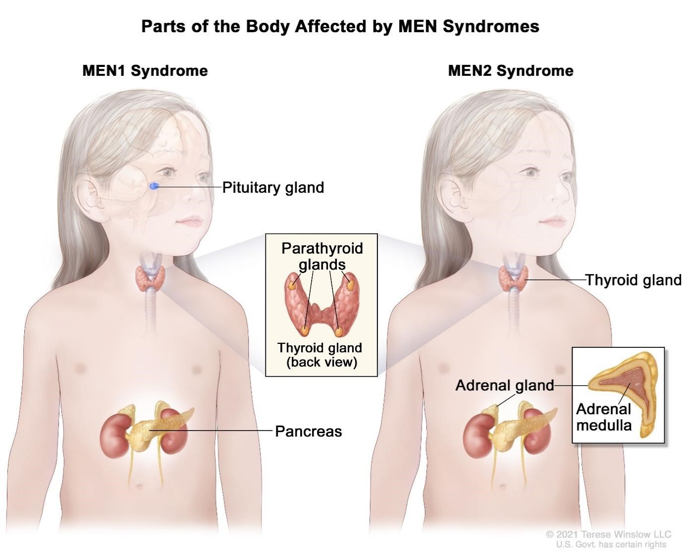 Các cơ quan thường bị ảnh hưởng trong hội chứng MEN 1 và MEN 2