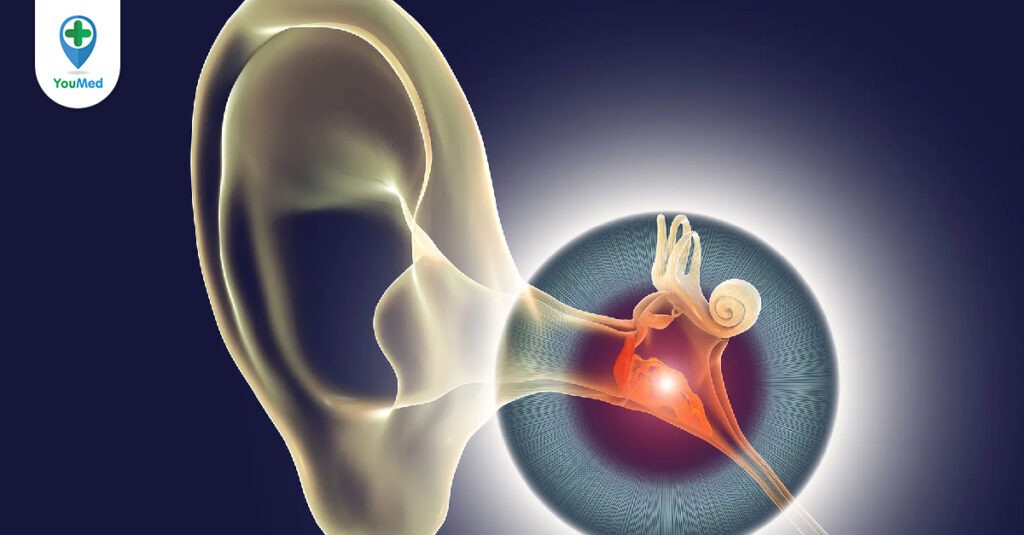Nguyên nhân viêm tai giữa và cách phòng ngừa