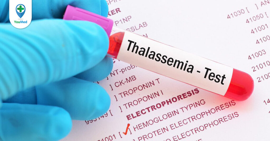 Các xét nghiệm Thalassemia cần thực hiện là gì?