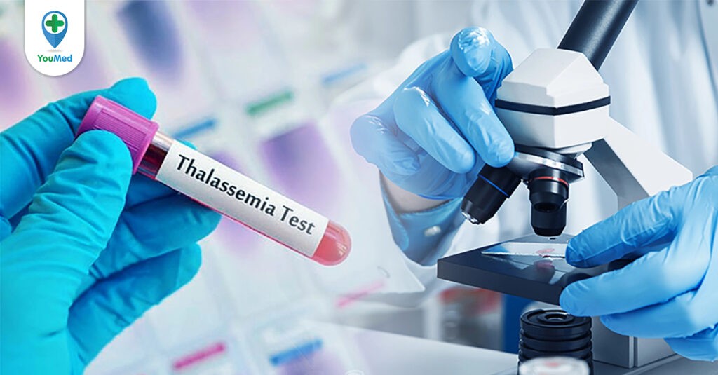 Xét nghiệm Thalassemia hết bao nhiêu tiền? Xét nghiệm Thalassemia ở đâu?