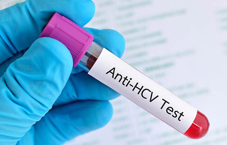 Xét nghiệm viêm gan C có mục đích xác định đối tượng có bị nhiễm HCV hay không