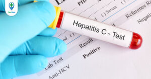 Các xét nghiệm chẩn đoán viêm gan C bao gồm những gì? Cần lưu ý gì khi đi xét nghiệm viêm gan C?