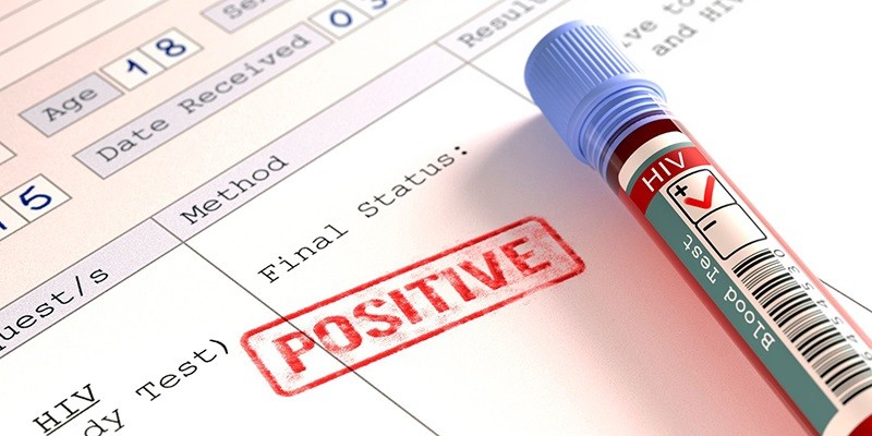 Positive trong xét nghiệm cho thấy bạn có thể đã bị bệnh hoặc đang mang mầm bệnh