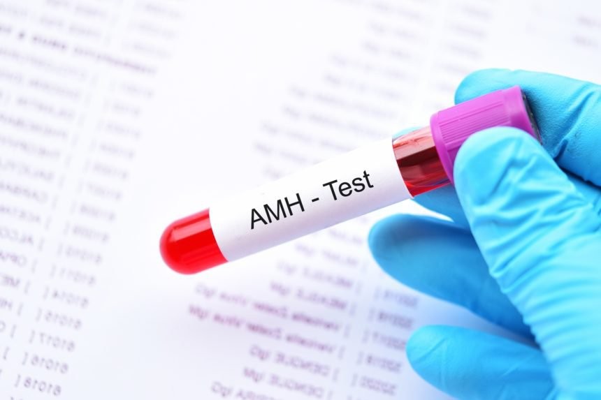 Xét nghiệm AMH giúp đo lượng hormone anti-Mullerian (AMH) trong máu