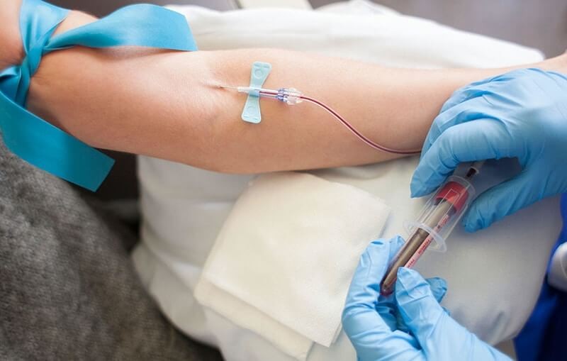 Xét nghiệm máu là phương pháp thường được áp dụng