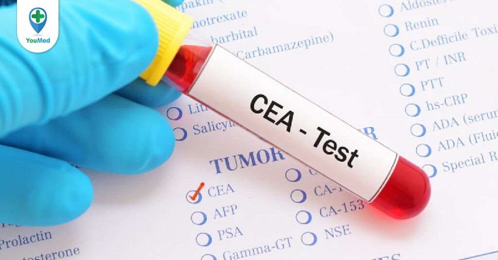 Giá xét nghiệm CEA bao nhiêu tiền và ở đâu?