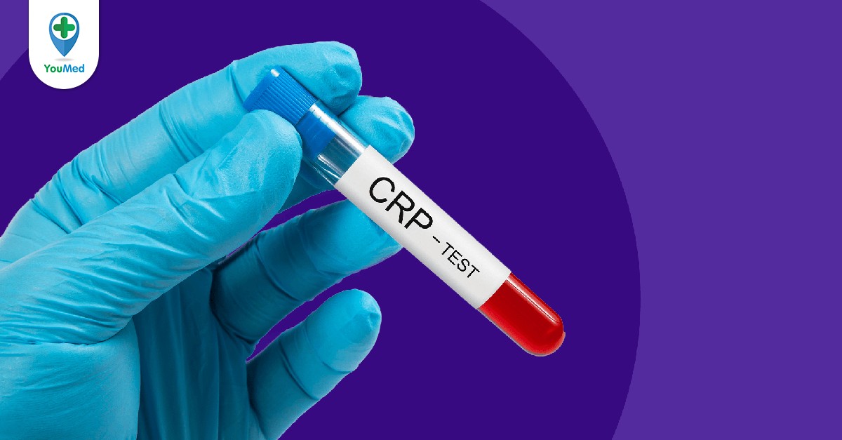 Ai nên được khuyến cáo xét nghiệm máu CRP?
