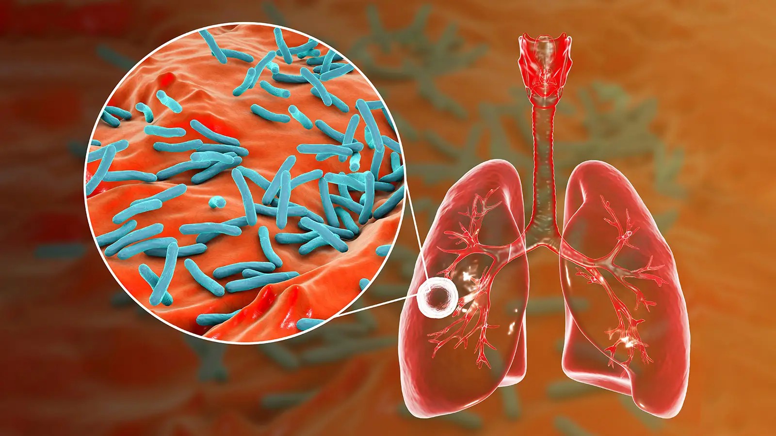 Lao phổi là bệnh truyền nhiễm nguy hiểm