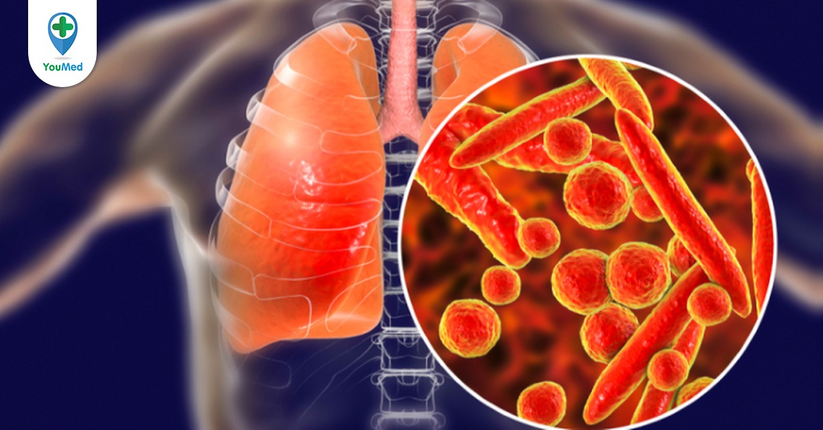 Lao phổi và NTM (Nontuberculosis Mycobacteria) có điểm gì khác biệt trong quá trình xét nghiệm?
