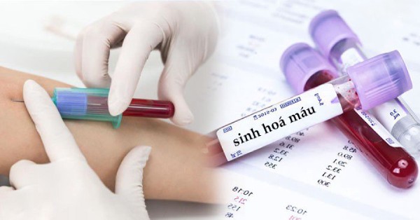 Xét nghiệm sinh hóa máu có thể được chỉ định để kiểm tra chức năng tuyến giáp hoặc đường huyết