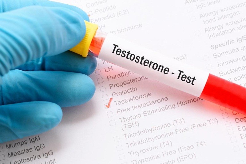 Xét nghiệm testosterone là một trong những xét nghiệm nội tiết ở nam giới.