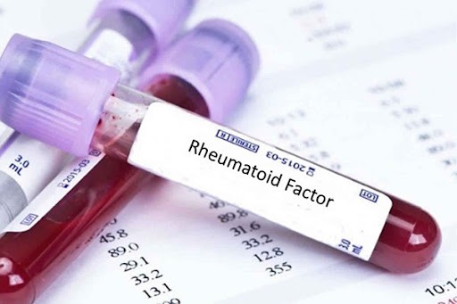 Lấy máu tĩnh mạch trong xét nghiệm RF