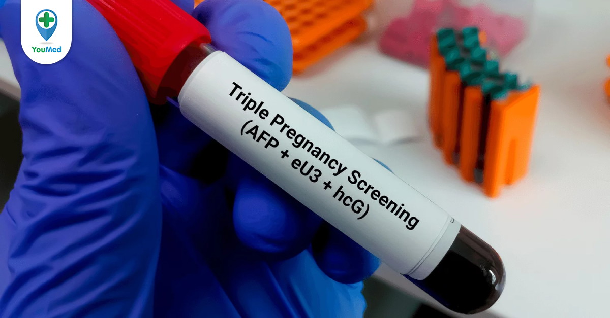 Giải thích làm triple test là gì và tại sao cần phải làm