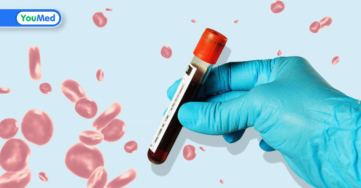Ý nghĩa và lợi ích của giấy xét nghiệm ung thư máu trong việc chẩn đoán bệnh?
