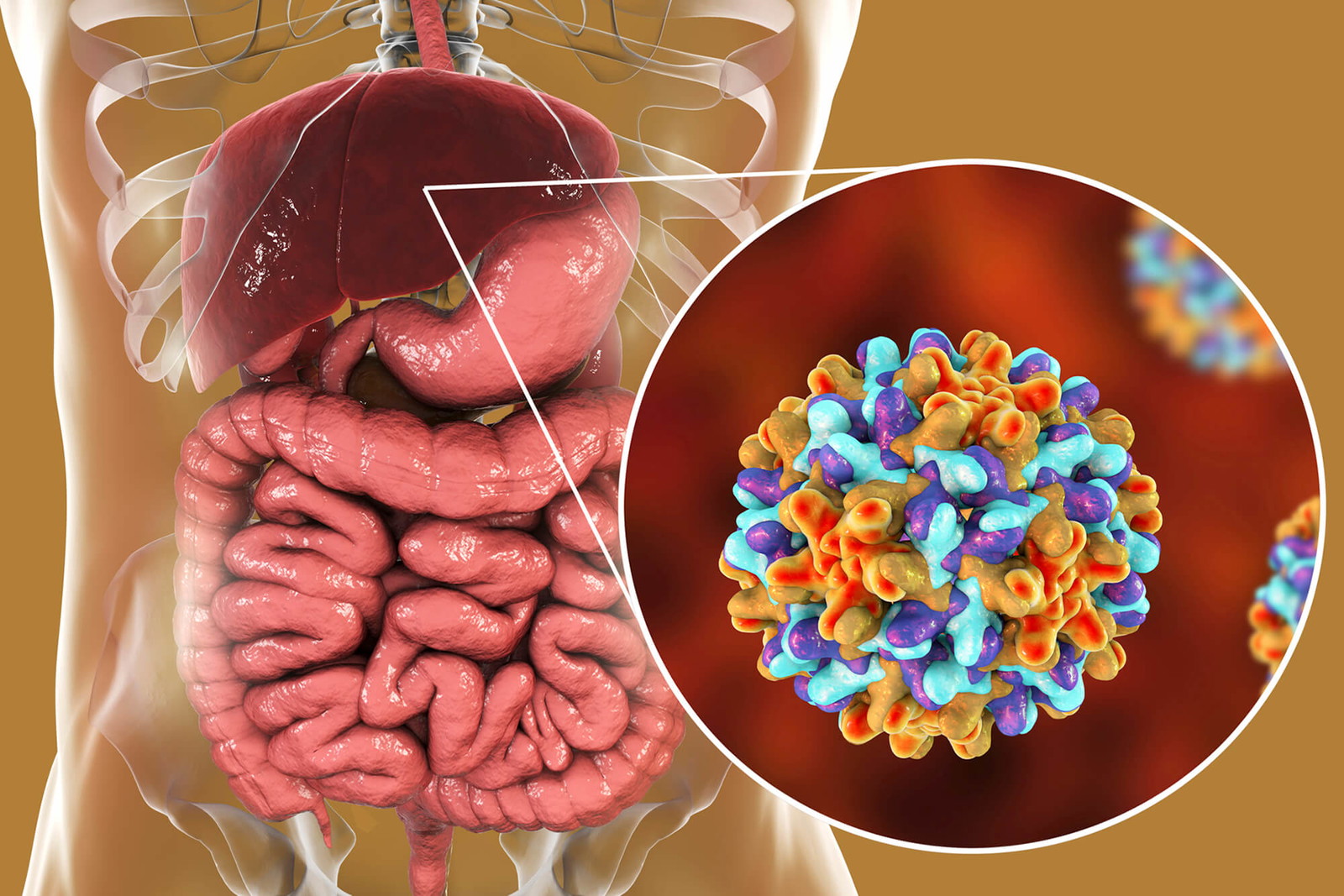 Viêm gan B là bệnh lý truyền nhiễm do virus HBV gây ra.