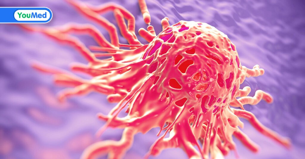 Ung thư cổ tử cung có lây không? Có di truyền không?