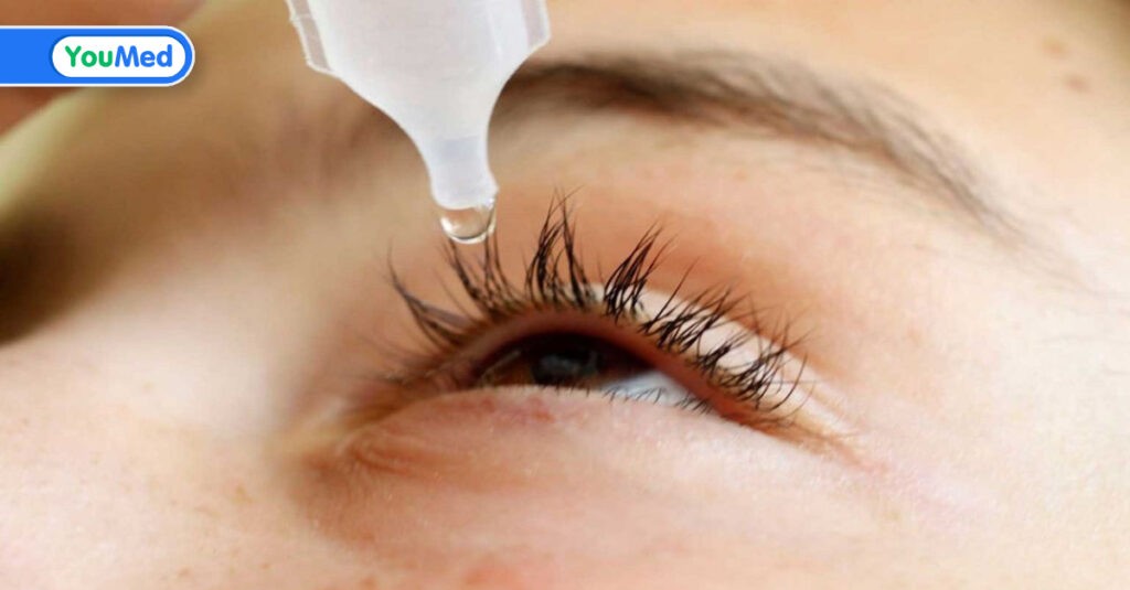 Các cách chữa đau mắt đỏ được sử dụng hiện nay