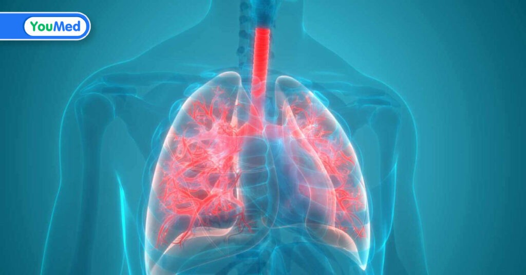 Viêm phổi có lây không? Câu trả lời của bác sĩ