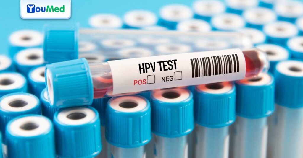 Hiểu đúng về kết quả xét nghiệm HPV dương tính và âm tính