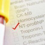 Vai trò của xét nghiệm NT-proBNP