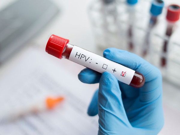 Xet nghem HPV de tra loi cau hoi kham phu khoa la kham gi