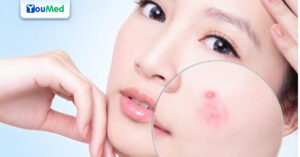 9 phòng khám da liễu Quận 10 TP.HCM hiện đại, uy tín