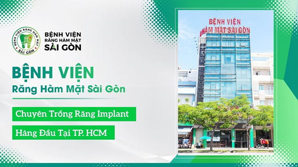 Bệnh viện chuyên trồng răng Implant hàng đầu TP HCM