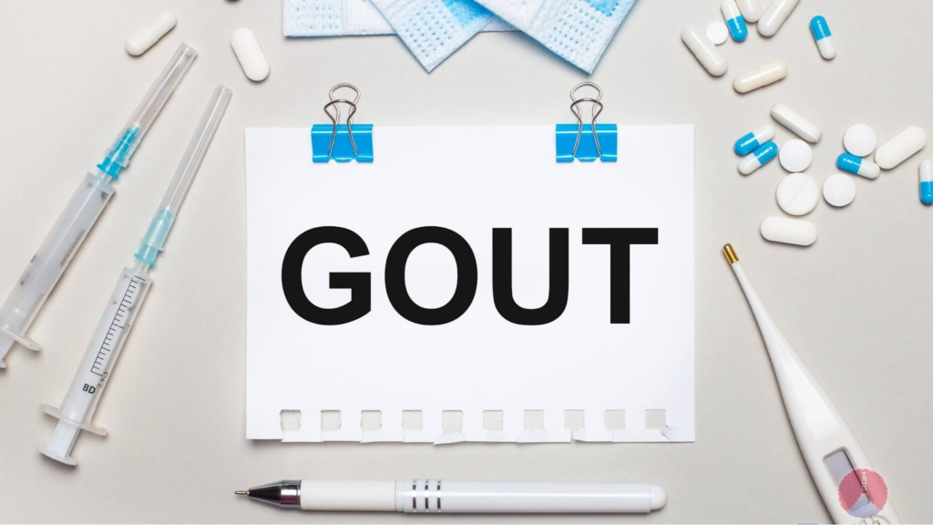 Bác sĩ chữa bệnh gút giỏi TPHCM