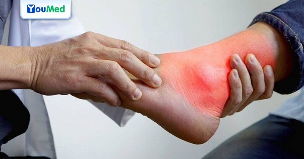 Top 5 Bác sĩ chữa bệnh gút giỏi TPHCM mà người bệnh có thể đặt lịch
