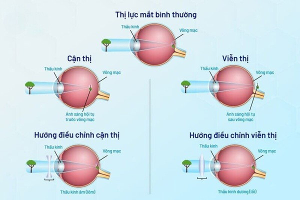 Bệnh viện cung cấp dịch vụ điều trị hầu hết các loại bệnh về Mắt